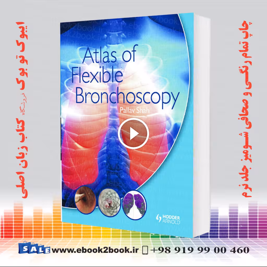 Atlas of Flexible Bronchoscopy