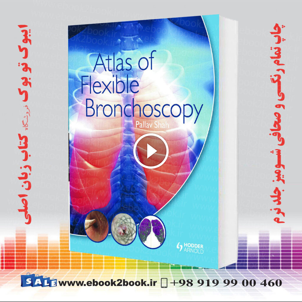 Atlas of Flexible Bronchoscopy