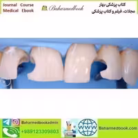 Direct and Indirect Adhesive Restorations video course price 36€ - کتاب پزشکی بهار
