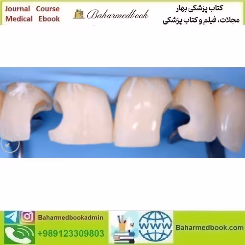 Direct and Indirect Adhesive Restorations video course price 36€ - کتاب پزشکی بهار