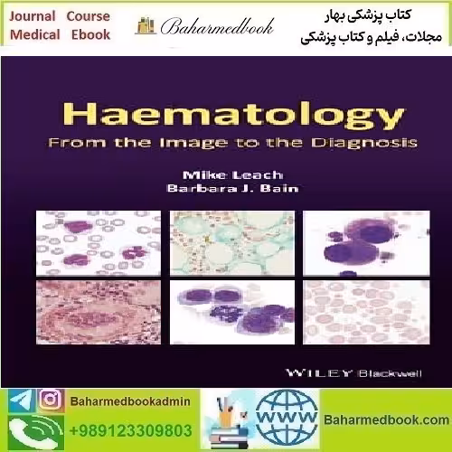 Haematology From the Image to the Diagnosis 2022