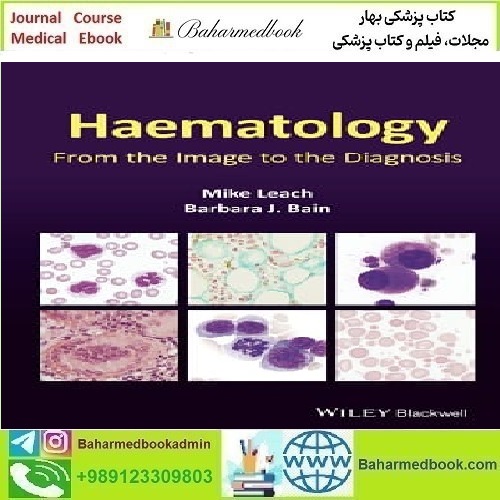 Haematology From the Image to the Diagnosis 2022