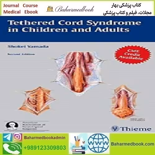 Tethered Cord Syndrome in Children and Adults 2010 TRUE