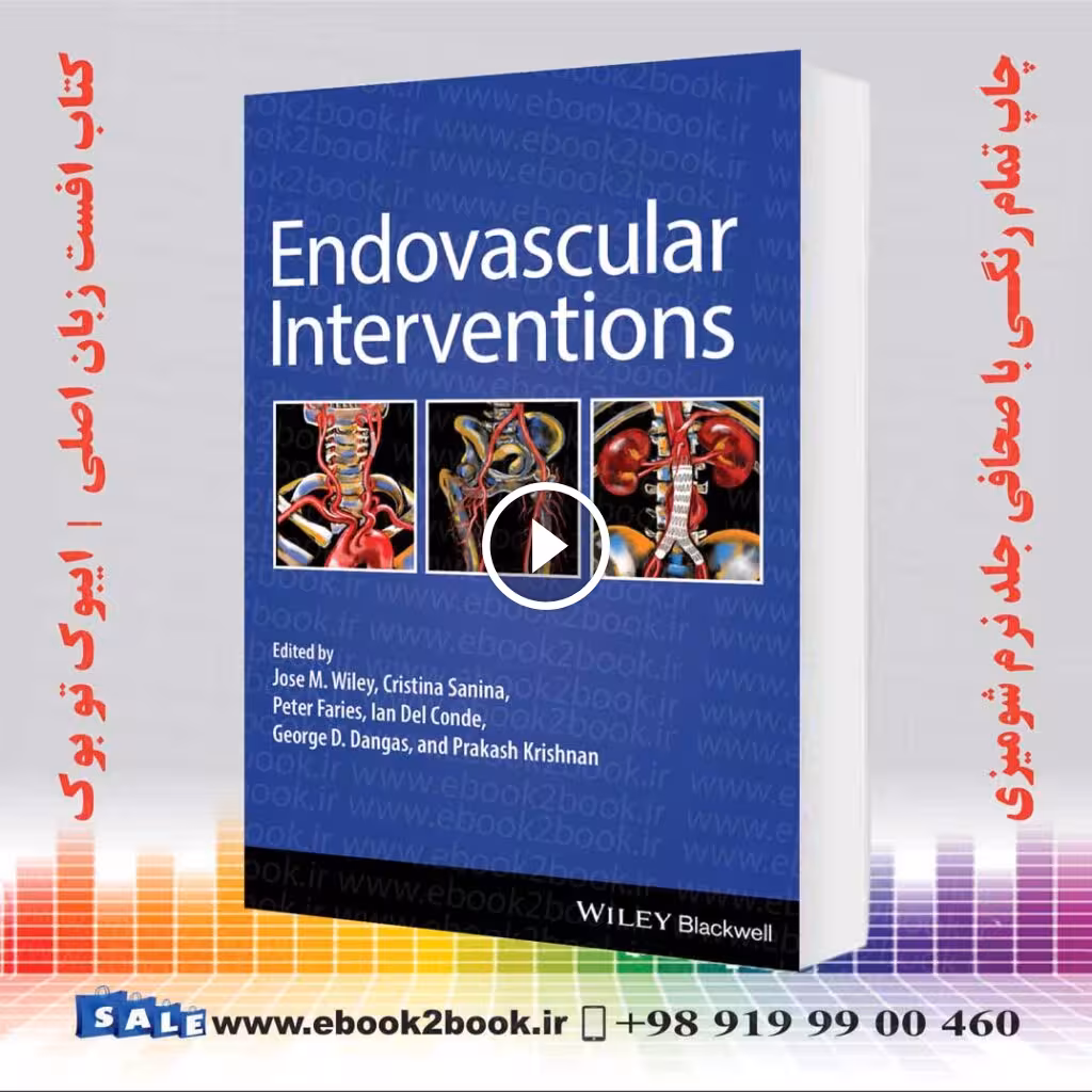 Endovascular Interventions