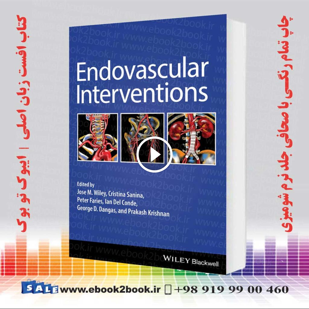 Endovascular Interventions