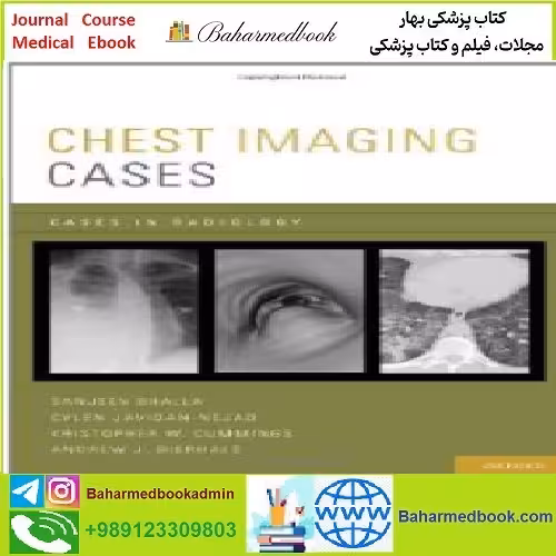 Chest Imaging Cases TRUE PDF price 1€ - کتاب پزشکی بهار