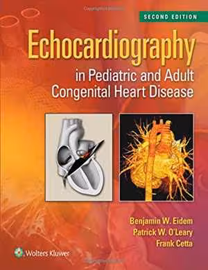 [PDF] دانلود کتاب Echocardiography In Pediatric And Adult Congenital Heart Disease, 2nd ed, 2014