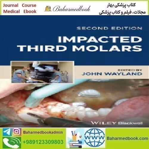 Impacted Third Molars 2024 TRUE PDF price 1€ - کتاب پزشکی بهار