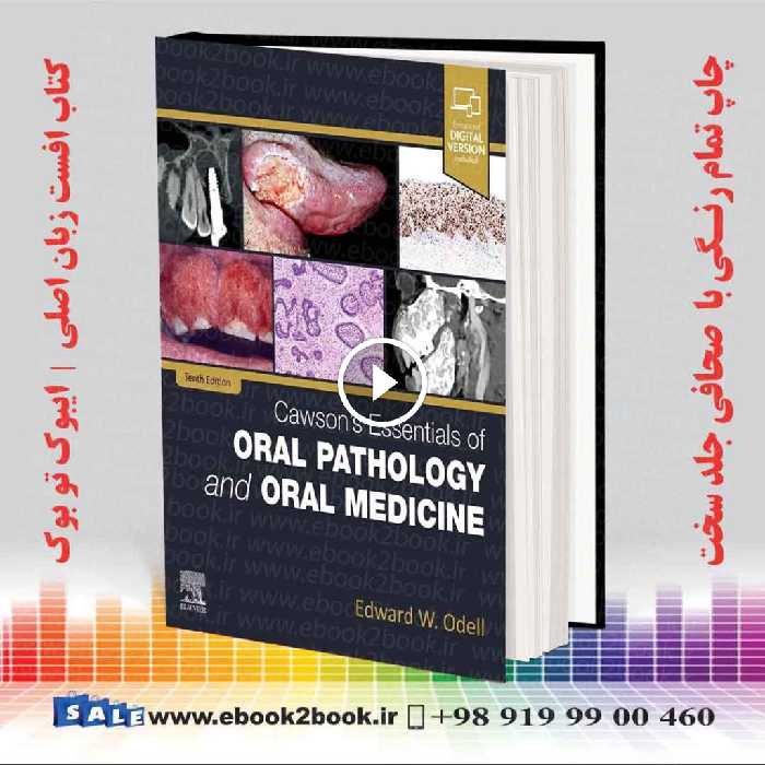 Cawson’s Essentials of Oral Pathology and Oral Medicine 10th Edition