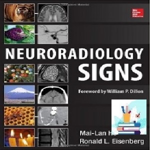Neuroradiology Signs TRUE PDF price 1€