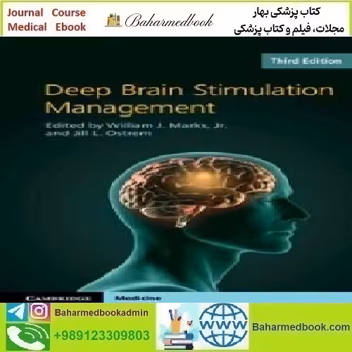 Deep Brain Stimulation Management 2022 TRUE PDF price 1€ - کتاب پزشکی بهار