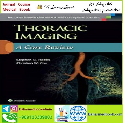 Thoracic Imaging A Core Review CONVERTEF PDF price 1€ - کتاب پزشکی بهار
