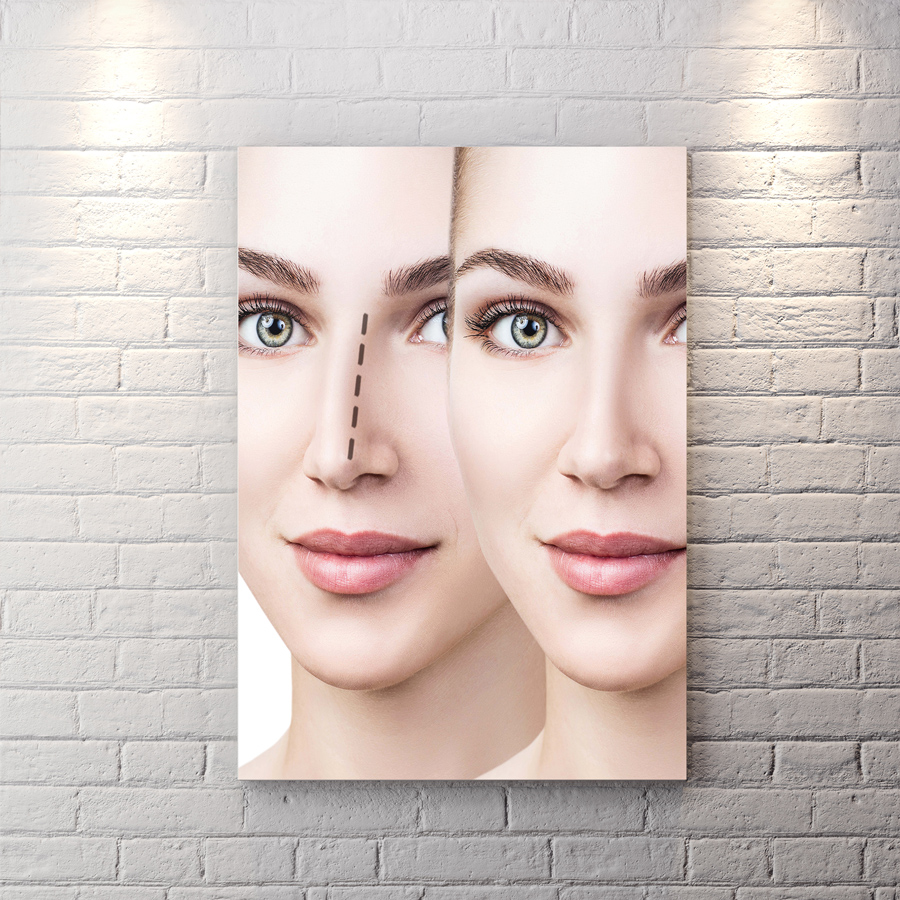 تابلو شاسی برای مطب دکتر جراح بینی BAs-8975