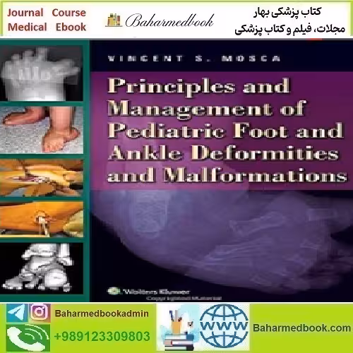 Principles and Management of Pediatric Foot and Ankle Deformiti