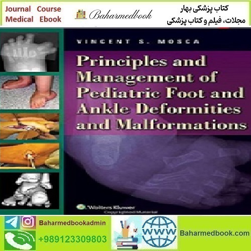 Principles and Management of Pediatric Foot and Ankle Deformiti