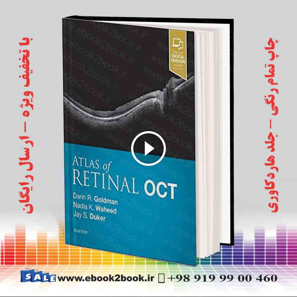 Atlas of Retinal OCT: Optical Coherence Tomography