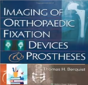 Imaging of Orthopaedic Fixation Devices and Prostheses TRUE