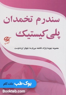 سندرم تخمدان پلی کیستیک