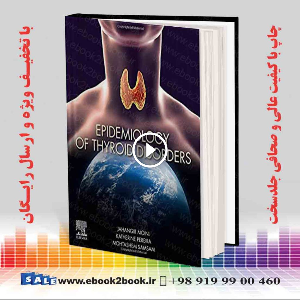 Epidemiology of Thyroid Disorders