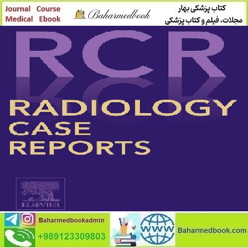 Radiology Case Reports Volume 19 Issue 1 to Issue 3 2024 TRUE PDF price 10€ - کتاب پزشکی بهار