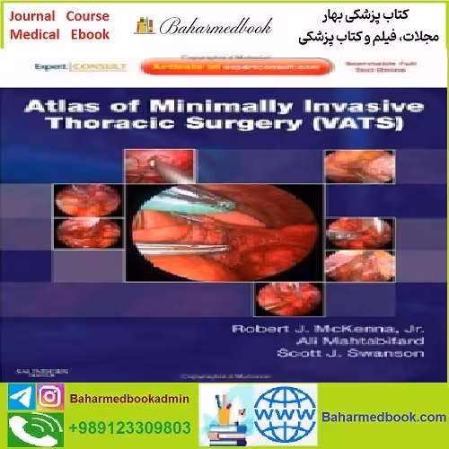 Atlas of Minimally Invasive Thoracic Surgery VATS TRUE PDF p