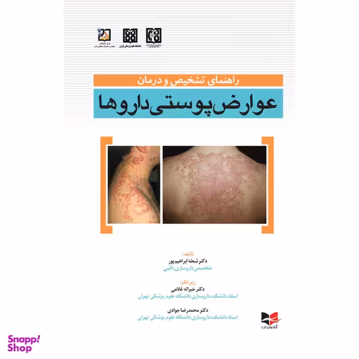 کتاب راهنمای تشخیص و درمان عوارض پوستی داروها اثر جمعی از نویسندگان انتشارات آبادیس طب