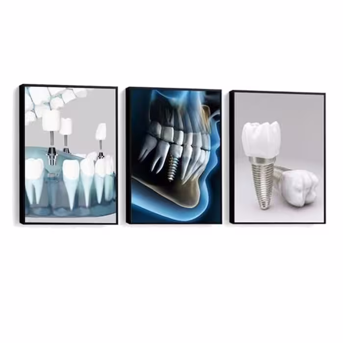 تابلو دکوراتیو مطب دندان پزشکی کد Nh6536 سایز 30.40 (پس کرایه)