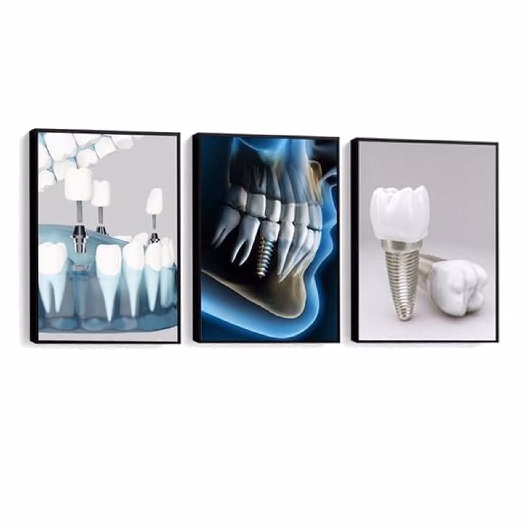 تابلو دکوراتیو مطب دندان پزشکی کد Nh6536 سایز 30.40 (پس کرایه)