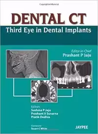 [PDF] دانلود کتاب Dental Ct - Third Eye In Dental Implants, 2013