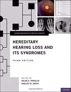 󾕇 دانلود کتاب Hereditary Hearing Loss And Its Syndromes, 3rd ed, 2013 - دانلود کتاب های دانشگاهی