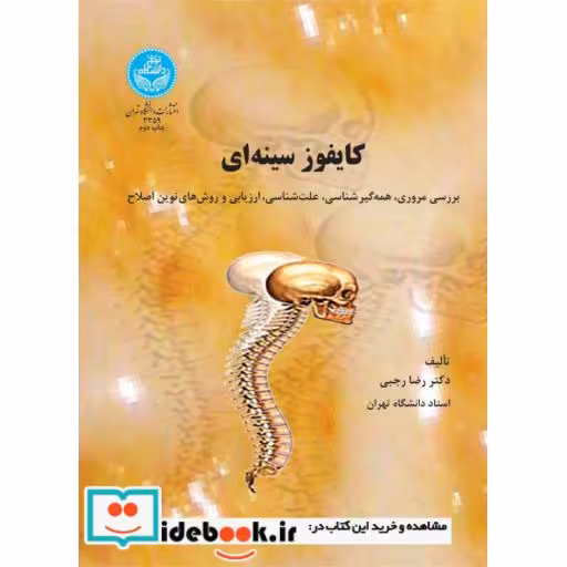 کتاب کایفوز سینه ای (بررسی مروری، همه گیر شناسی، ارزیابی و روش های نوین اصلاح)3359 اثر دکتر امیر صمدی-دکتر ابراهیم امیری تکلدانی