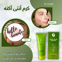 کرم آنتی آکنه گامنو  رفع جوش صورت 