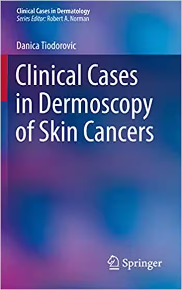 󾕇 دانلود کتاب Clinical Cases In Dermoscopy Of Skin Cancers, 2020 - دانلود کتاب های دانشگاهی