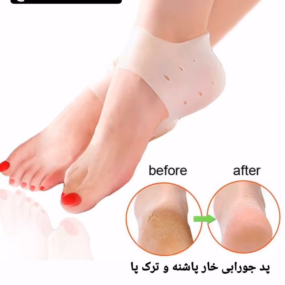 پد جورابی   خارپاشنه و ترک پاشنه