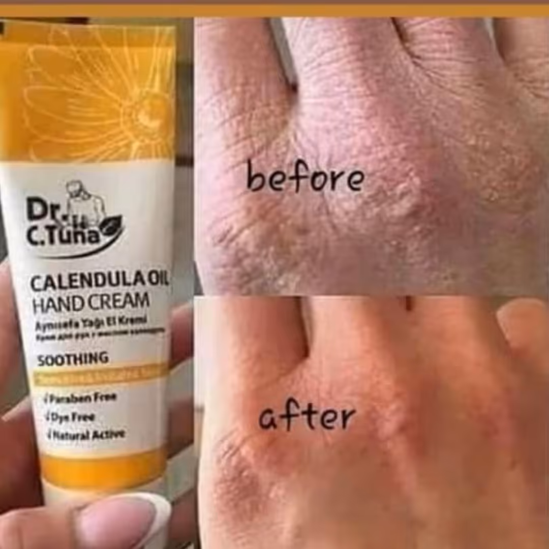 کرم مرطوب کننده دست (پوست خشک) 