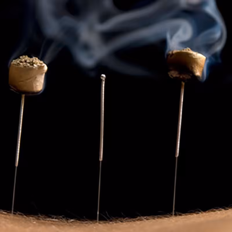 موکسا سوزنی.مناسب برای تسکین دردکمر و زانو