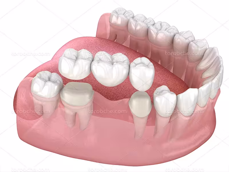 عکس باکیفیت دندان | گرافیک با طعم تربچه