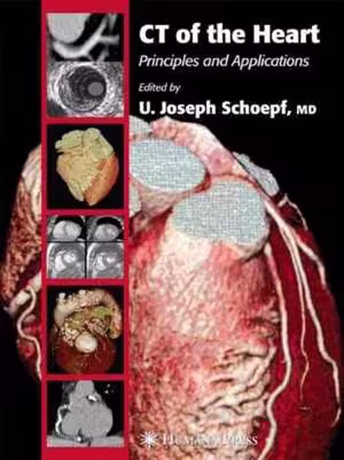 [PDF] دانلود کتاب Ct Of The Heart Principles And Applications, 2010