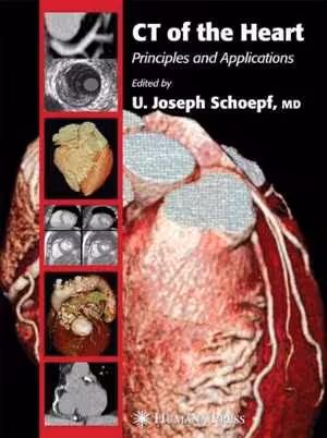 [PDF] دانلود کتاب Ct Of The Heart Principles And Applications, 2010