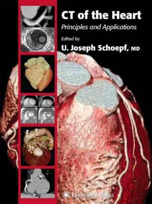 [PDF] دانلود کتاب Ct Of The Heart Principles And Applications, 2010