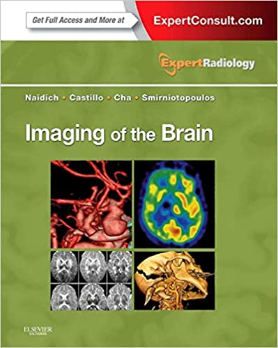  دانلود کتاب Imaging Of The Brain - Expert Radiology Series, 2012 - دانلود کتاب های دانشگاهی