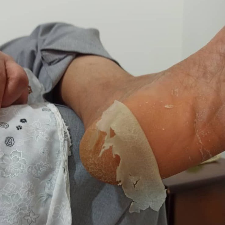 ماسک لایه بردار پا (دقیقا مثل عکس) کره ای