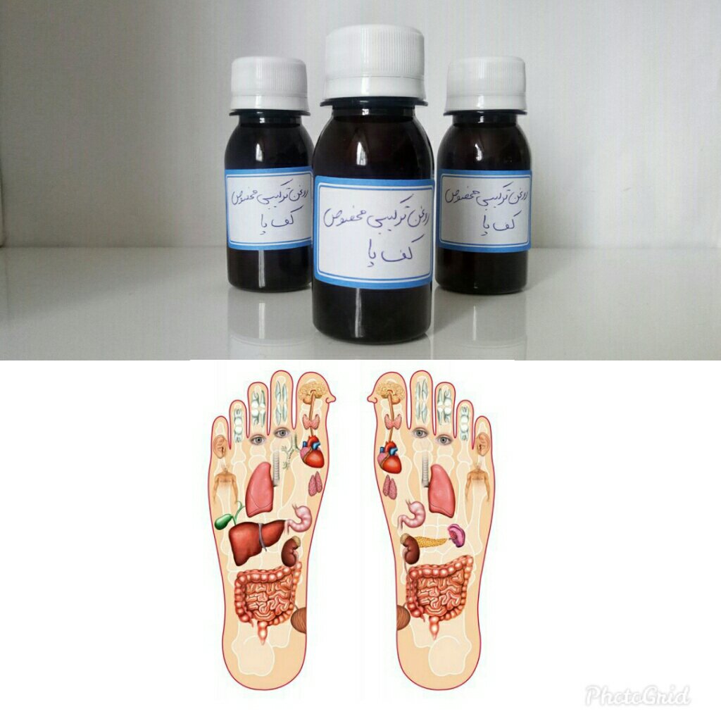 روغن ترکیبی کف پا