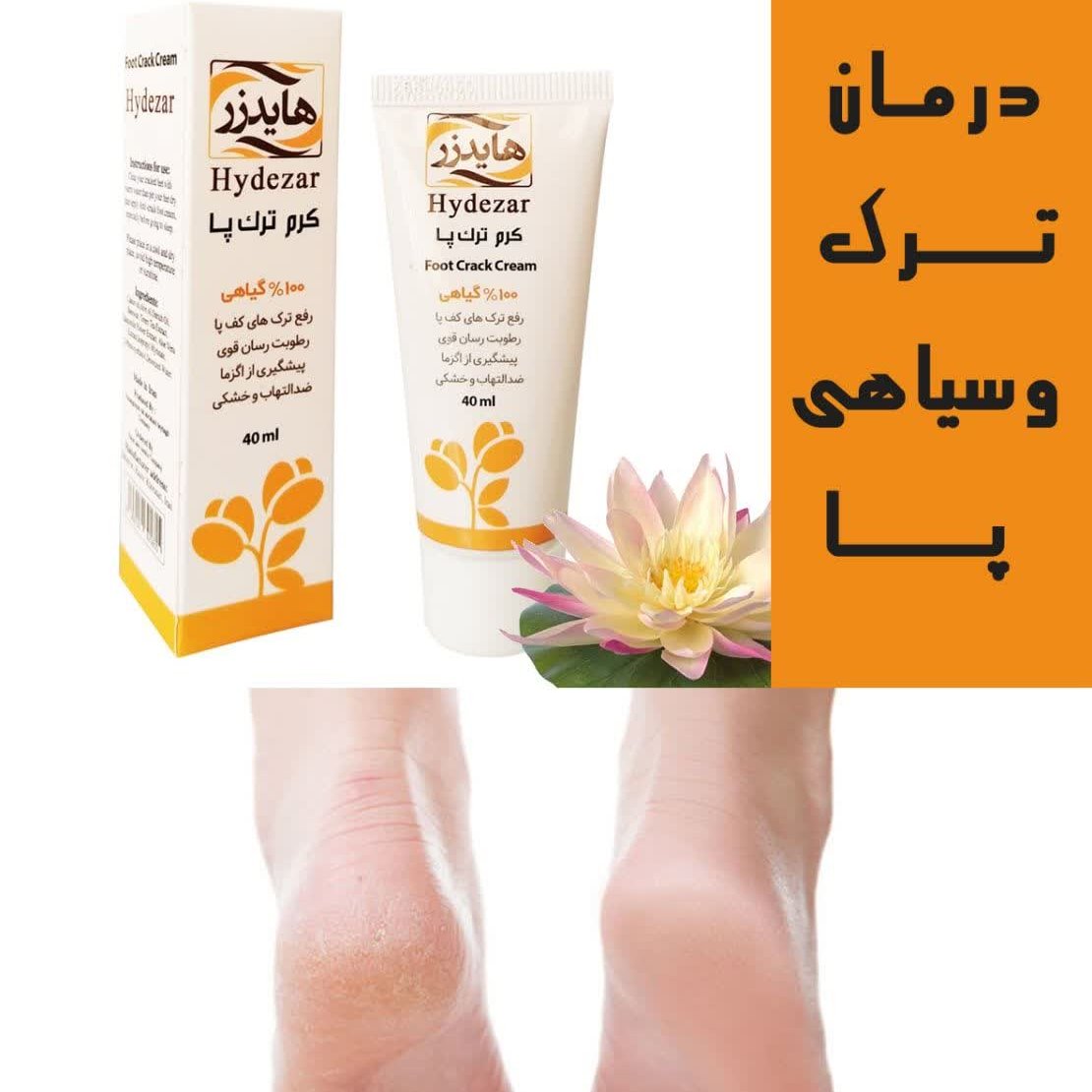 کرم ترک پا 