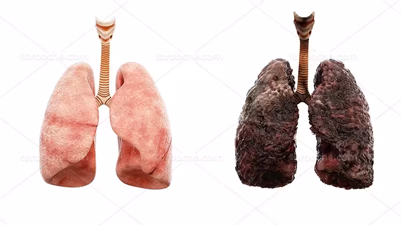 عکس ریه سالم و ناسالم | گرافیک با طعم تربچه