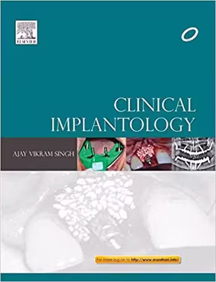 󾕇 دانلود کتاب Clinical Implantology, 2013 - دانلود کتاب های دانشگاهی