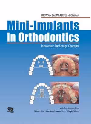 [PDF] دانلود کتاب Mini-Implants In Orthodontics - Innovative Anchorage Concepts, 2008