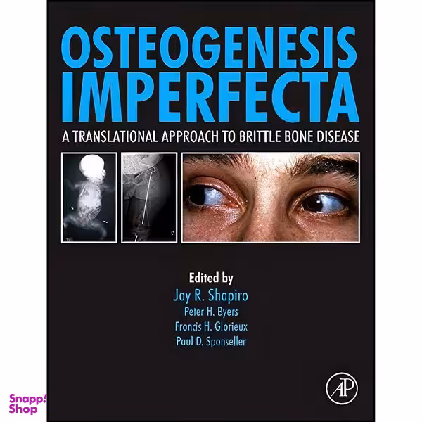 کتاب Osteogenesis Imperfecta اثر جمعي از نويسندگان انتشارات Academic Press