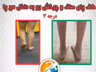 بهبود و اصلاح  و درمان انواع انحرافات عضلانی در باشگاه تندرستی و حرکات اصلاحی دل آسا