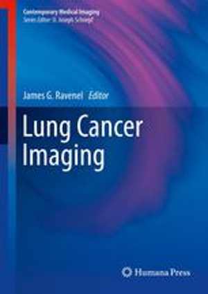 [PDF] دانلود کتاب Lung Cancer Imaging, 2013